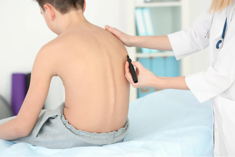 Chiropractor for scoliosis